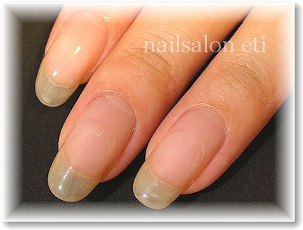 nail.jpg