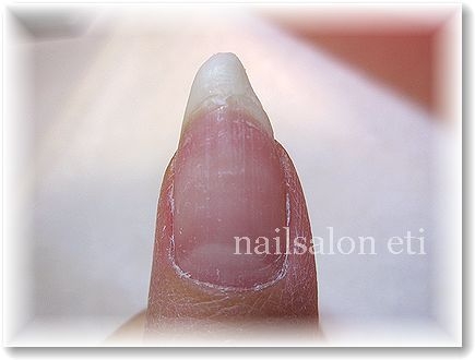 nail.jpg