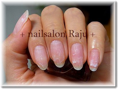 nail.jpg