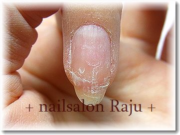 nail.jpg