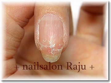 nail.jpg
