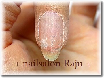 nail.jpg