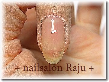 nail.jpg