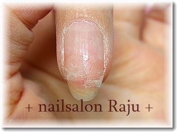 nail.jpg