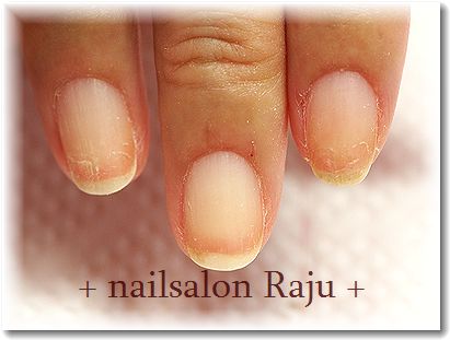 nail.jpg