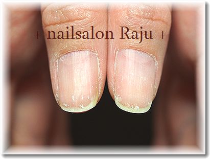 nail.jpg